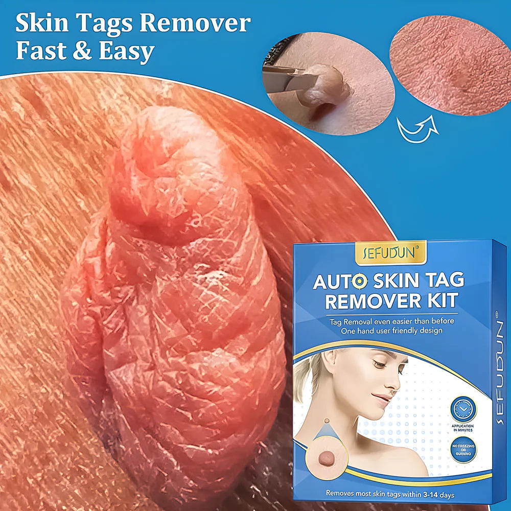 Best skin tag remover - cosmetic tools | 2025 | fast shipping
