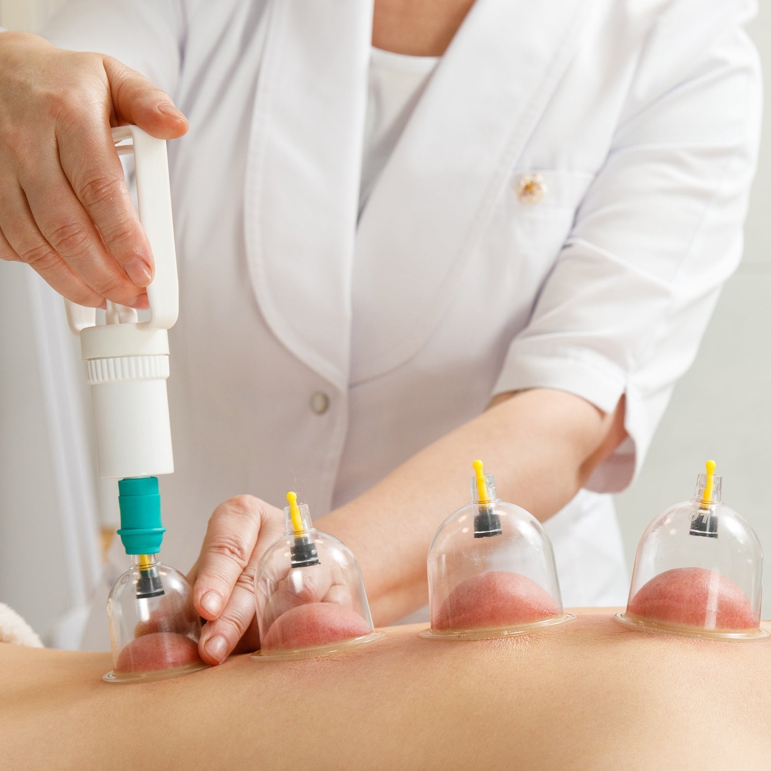 Vacuum Cupping Set 6 Pcs Kit
