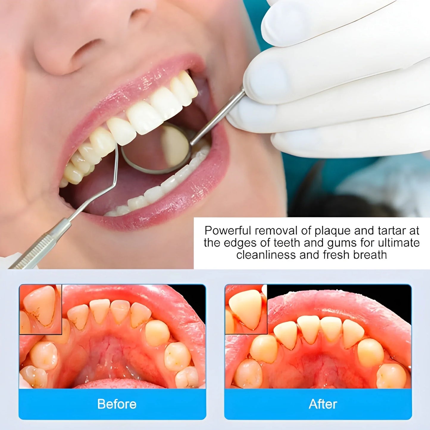 Best 7 in 1 stainless steel toothpick flossier set - home & garden | 2025 | fast shipping