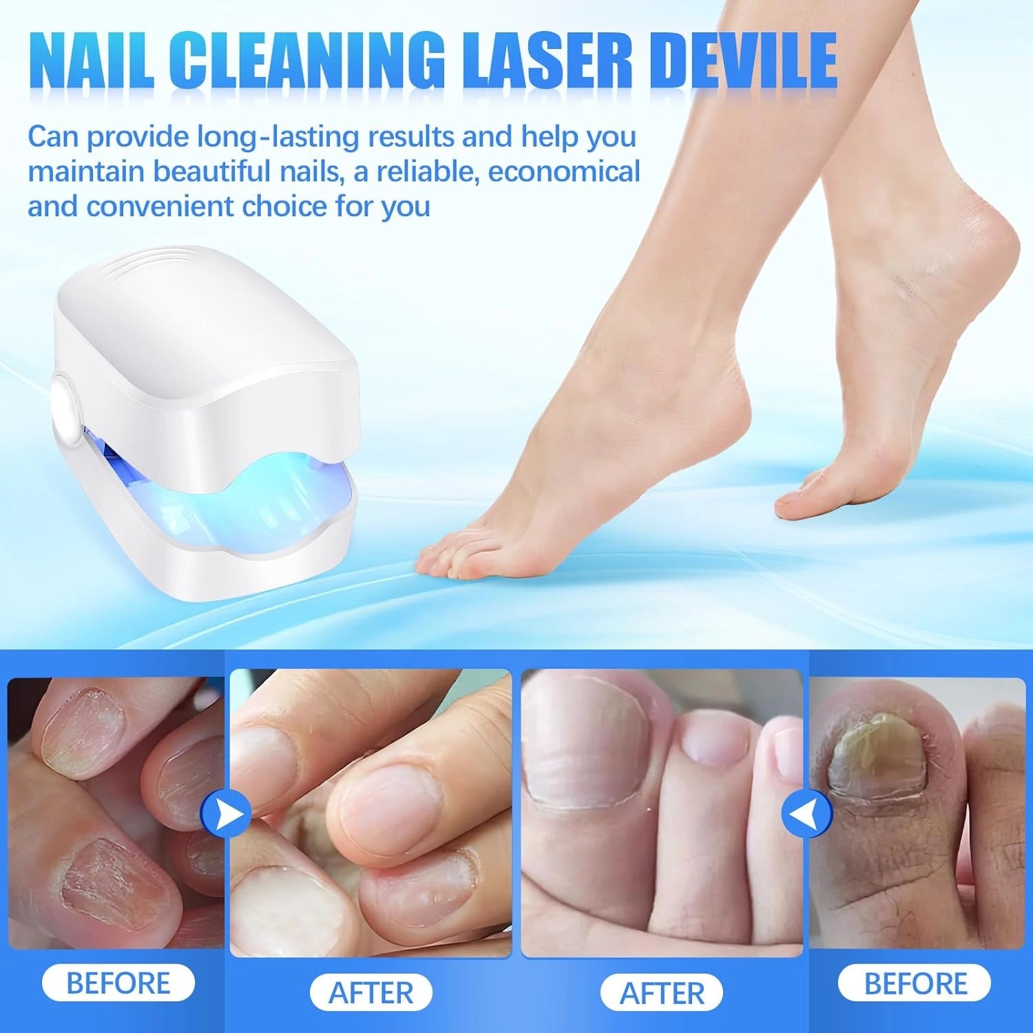 Rechargeable nail fungus laser device