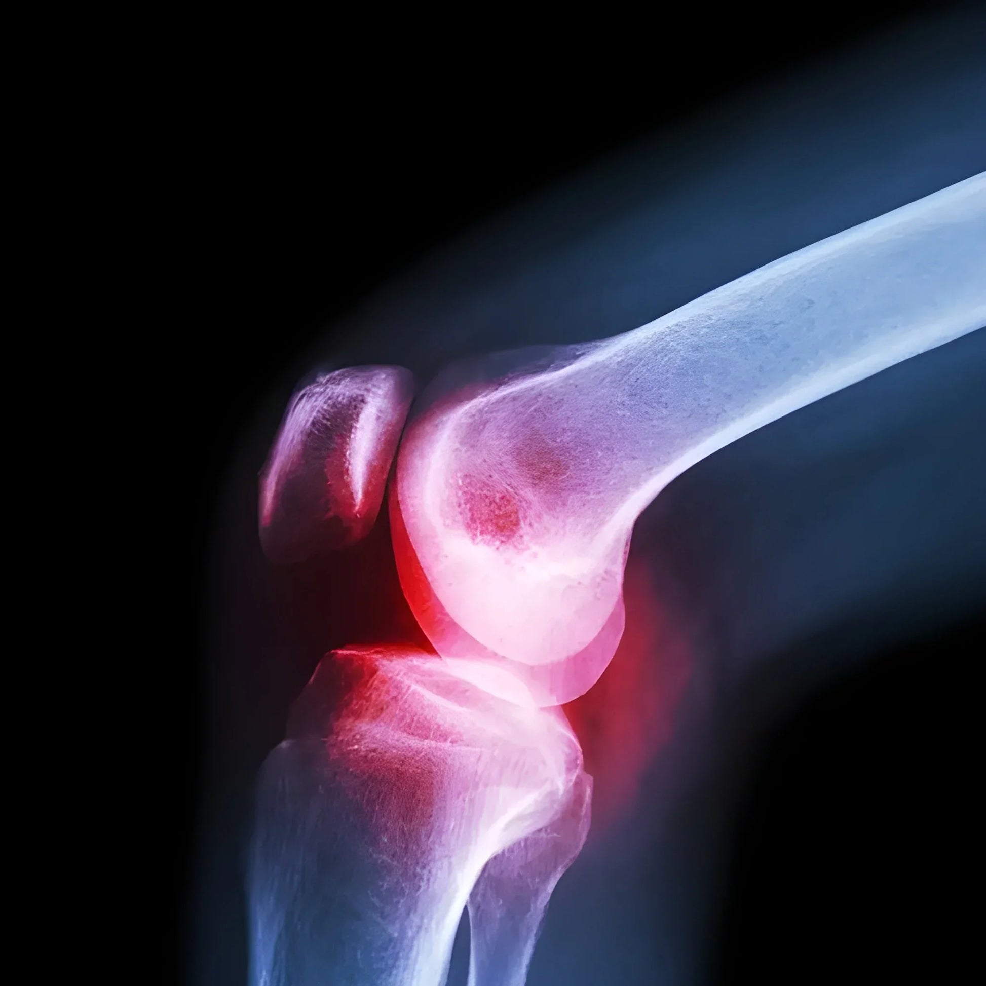 Best compression knee support brace - braces | 2025 | fast shipping