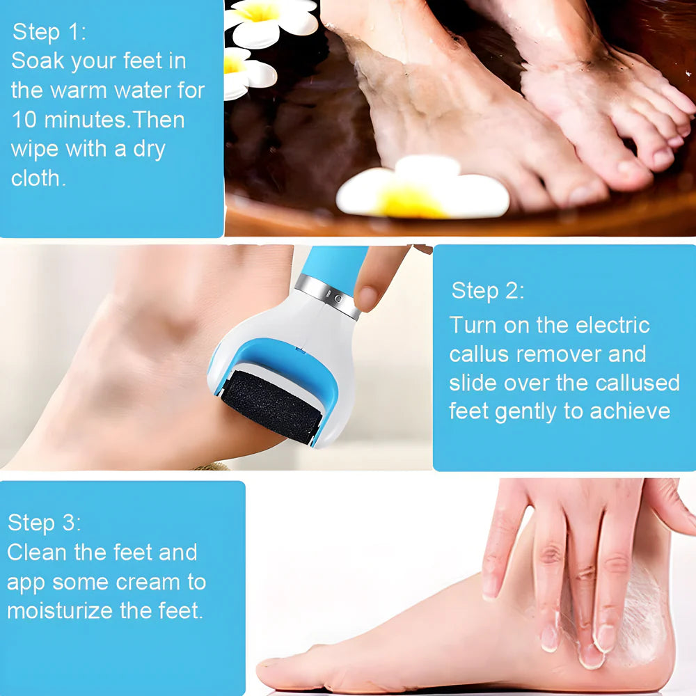 Best electronic foot callus remover - care | 2025 | fast shipping