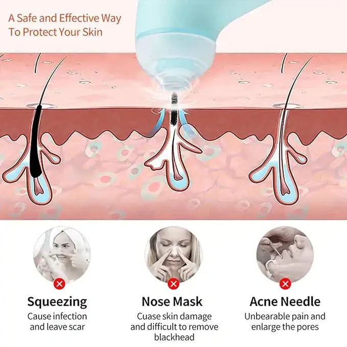 Best handheld vacuum pore cleaner - skin care extractors | 2025 | fast shipping