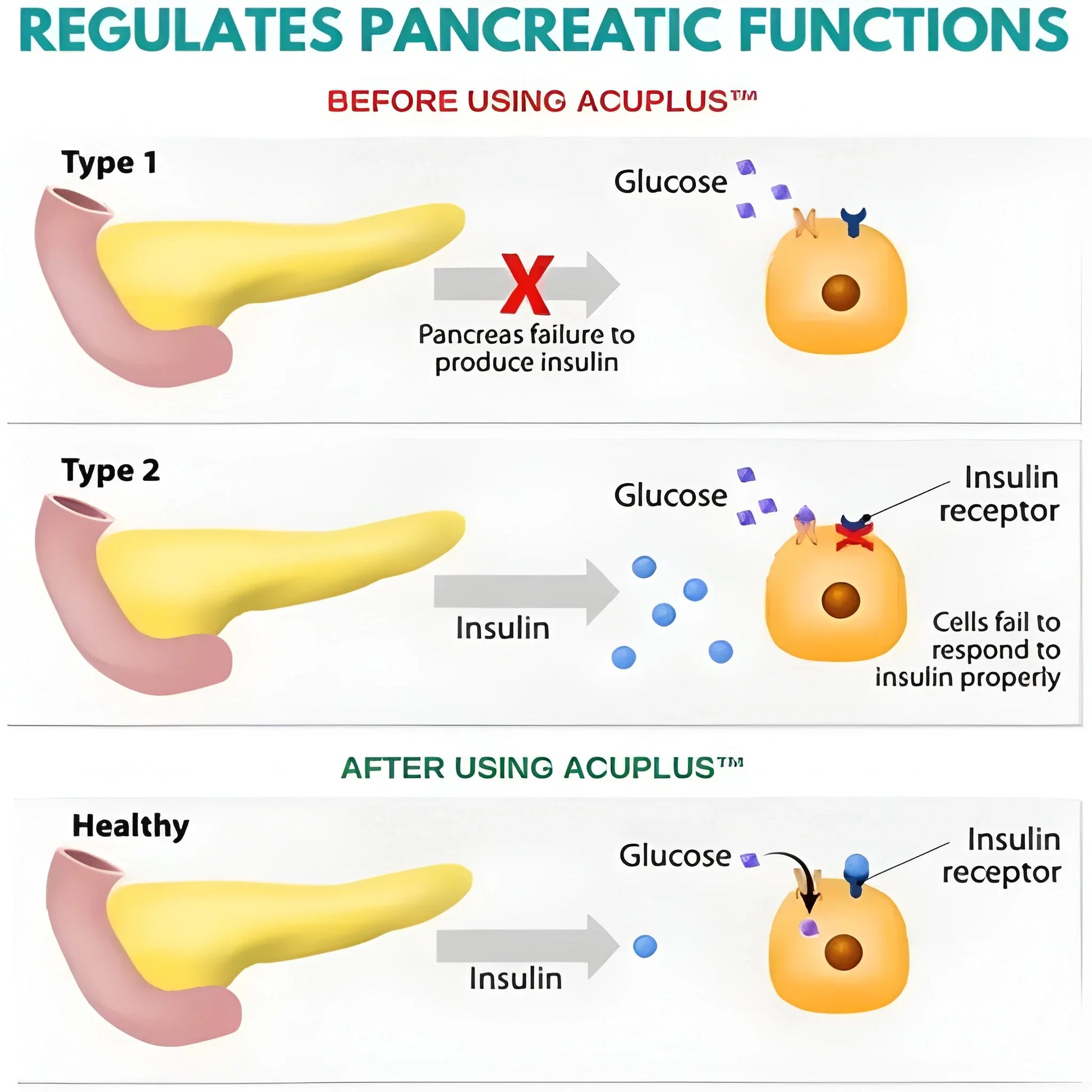 Best migraine relief acupressure clip - manual massage tools | 2025 | fast shipping