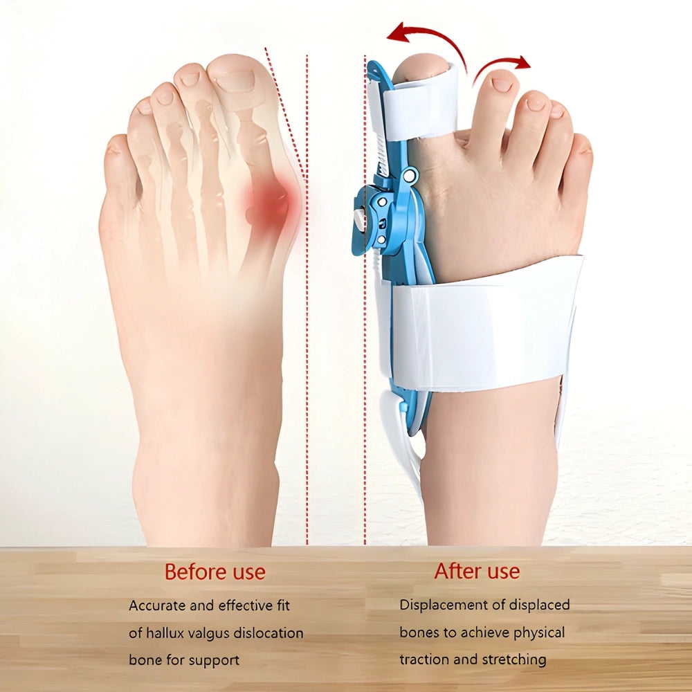 Best adjustable bunion pain relief - care supplies | 2025 | fast shipping