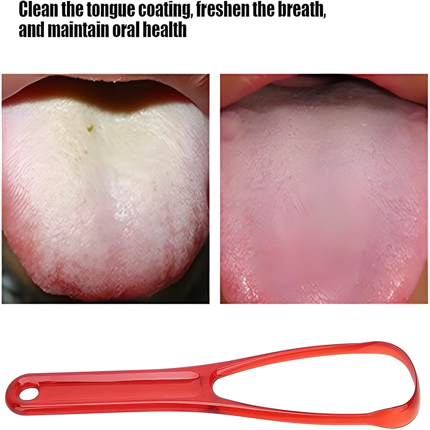 Professional Tongue Cleaner - Health & Personal Care