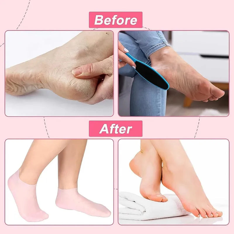Silicone Moisturizing Socks (1 Pair) - Health & Beauty
